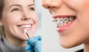 Smiling woman with braces next to a dental professional applying treatment