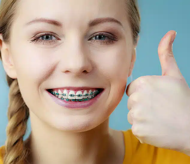 signs you may need braces