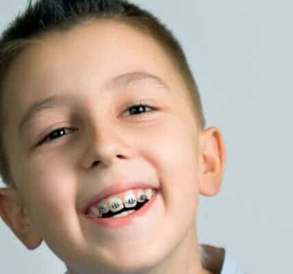 What Is a Palatal Expander and Does My Child Need One?