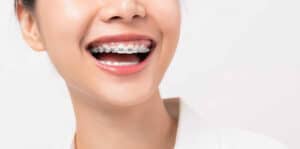 Patient choosing braces with orthodontist consultation